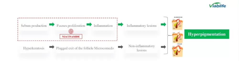 Nicotinamida en cosméticos: control eficaz de la grasa y supresión del acné